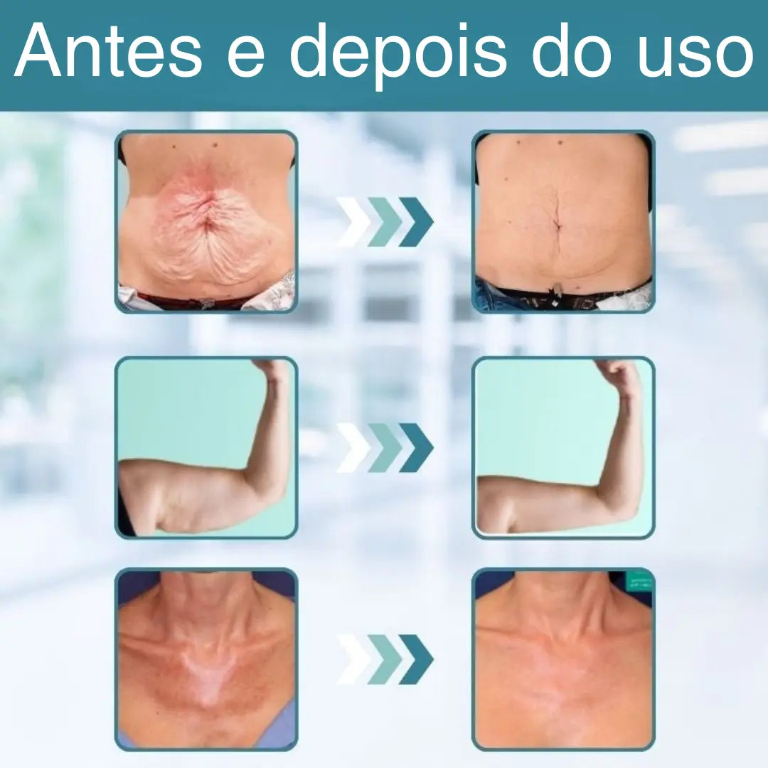 GlowEssence™ | Firma a pele flácida em 97% em apenas 24 horas!