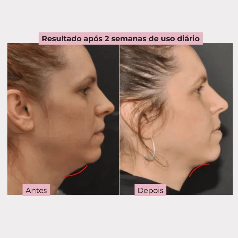 V-Liftup- Máscara de Contorno Facial - Suaviza Rugas, Papada e Modela o Rosto