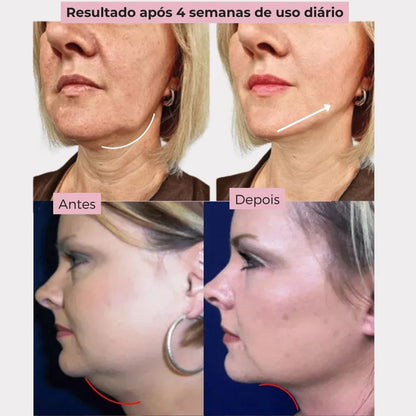 V-Liftup- Máscara de Contorno Facial - Suaviza Rugas, Papada e Modela o Rosto