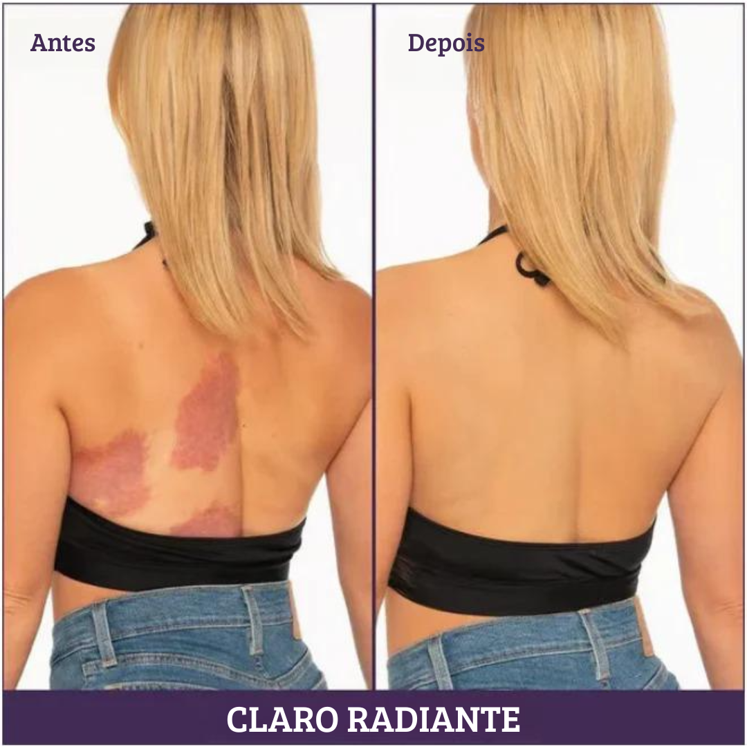 Body Skin Perfection veil