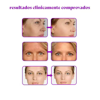 CollagenBoost Signature